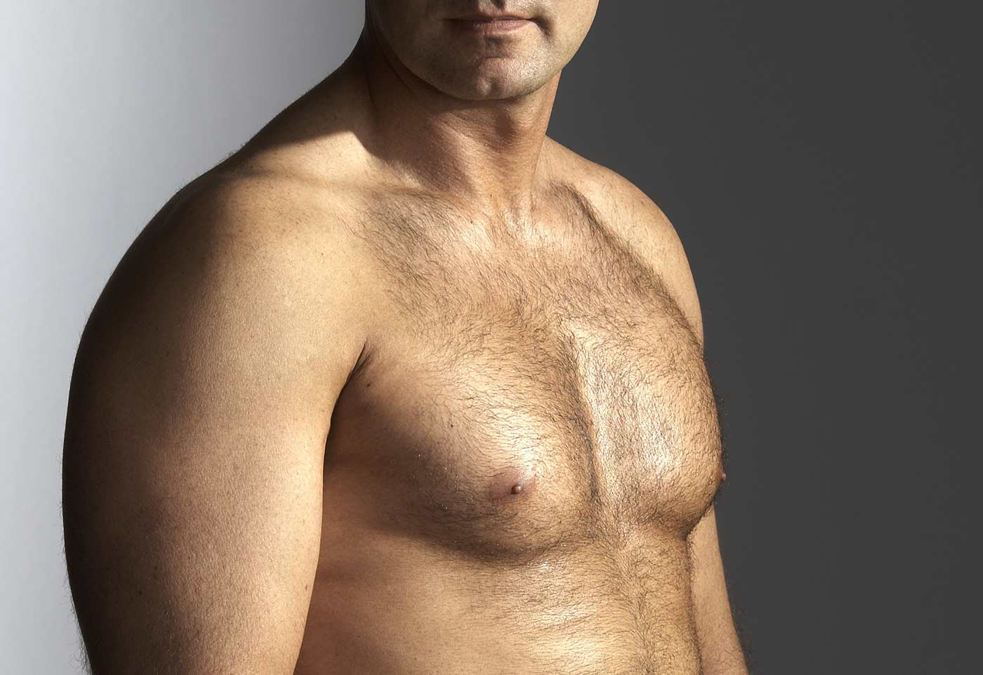 gynécomastie homme