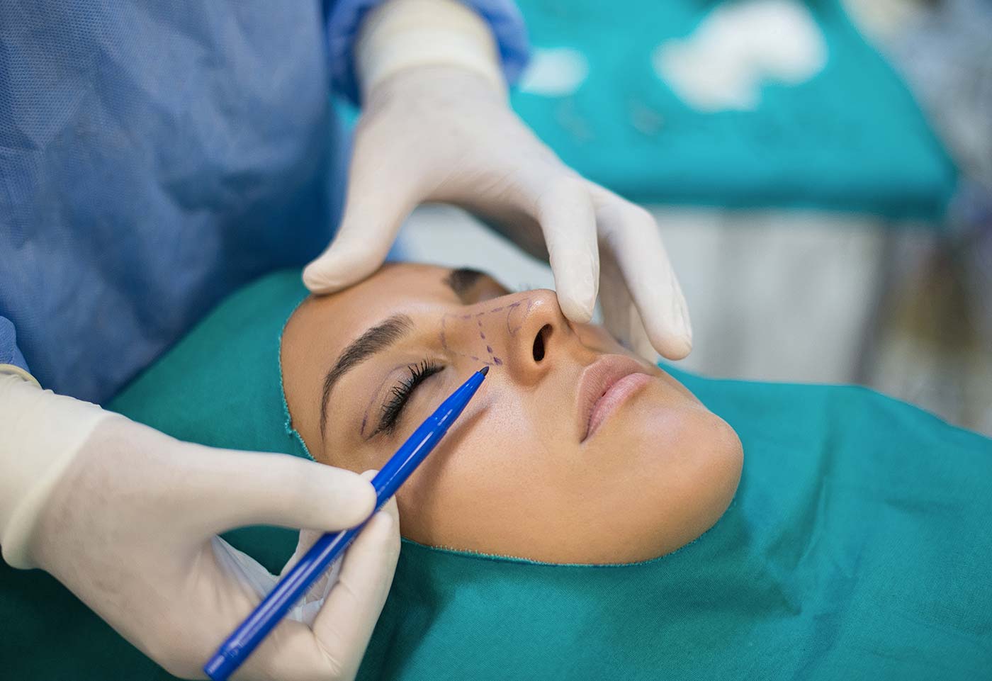 rhinoplastie